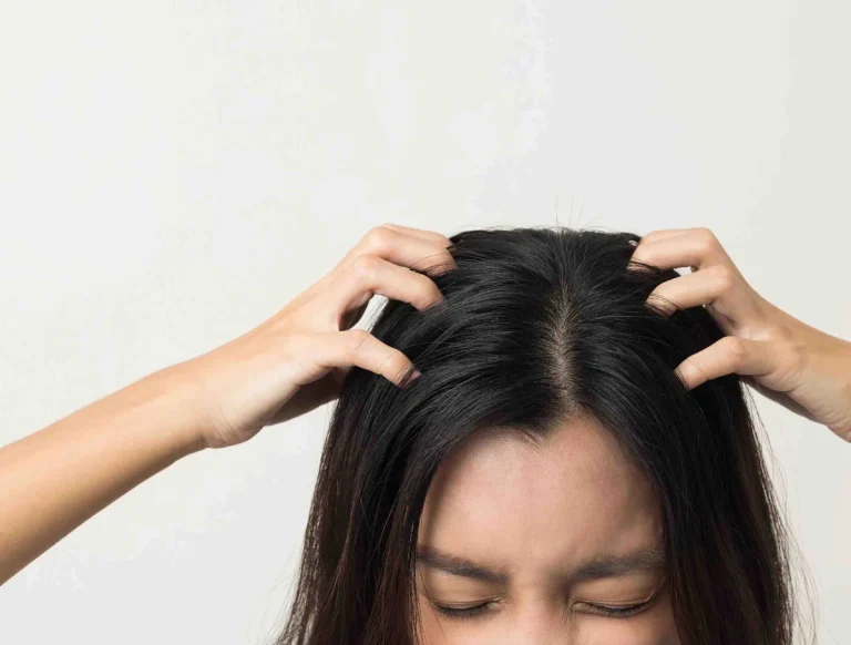 Sensitive scalp care — soothing an irritated scalp