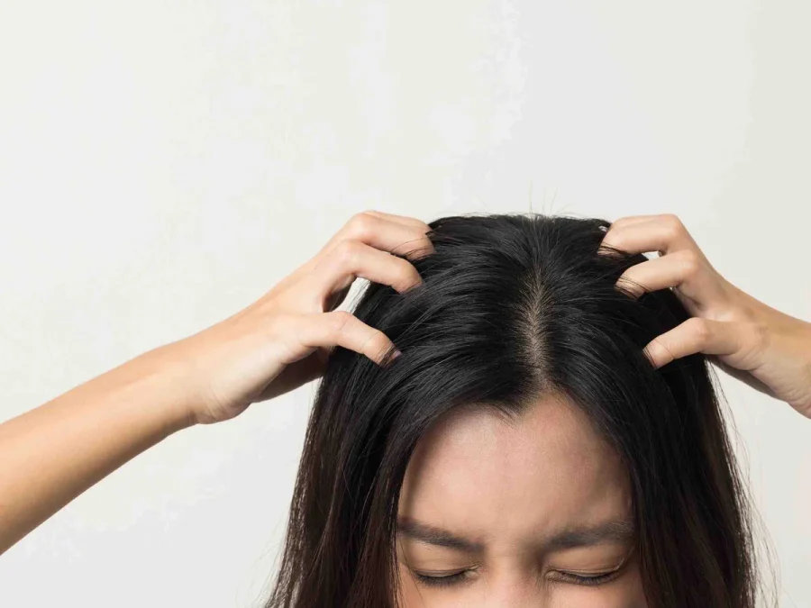 Sensitive scalp care — soothing an irritated scalp