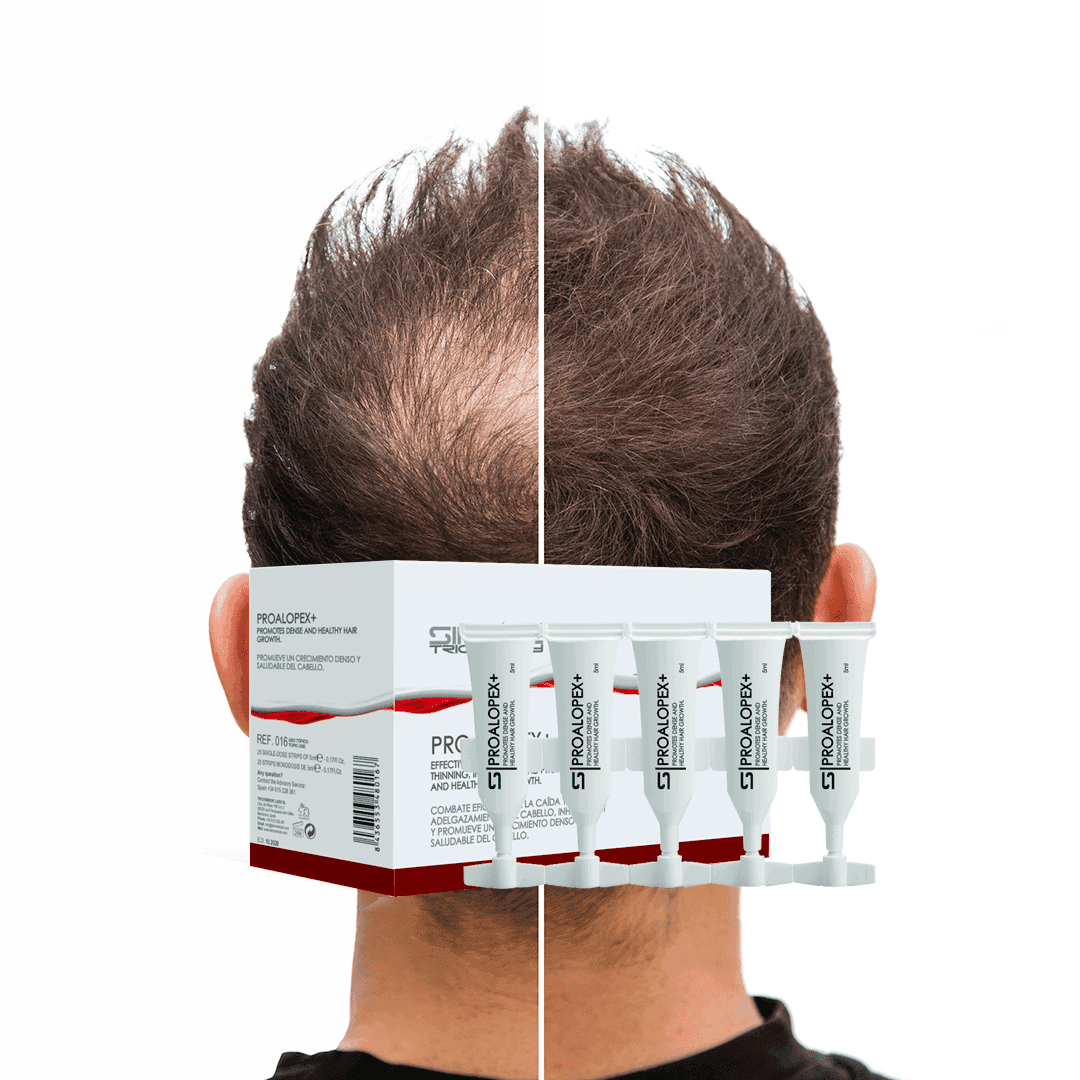 PROALOPEX+ box and mono-dose vials for androgenetic hair loss — SIMONE TRICHOLOGY