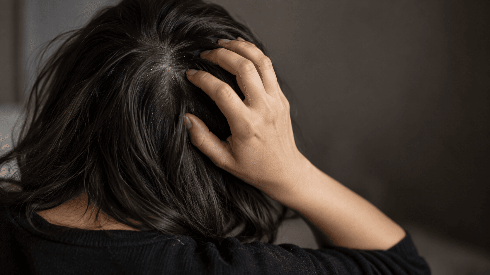 Itchy scalp and dandruff: woman pressing her fingertips into her crown, white flakes on the parting