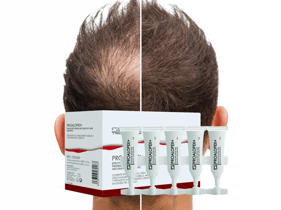 PROALOPEX+ box and mono-dose vials for androgenetic hair loss — SIMONE TRICHOLOGY