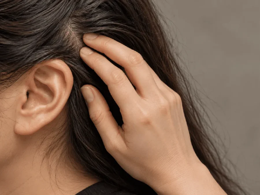 Itchy scalp: woman with dark hair gently pressing her fingertips to the scalp above her ear